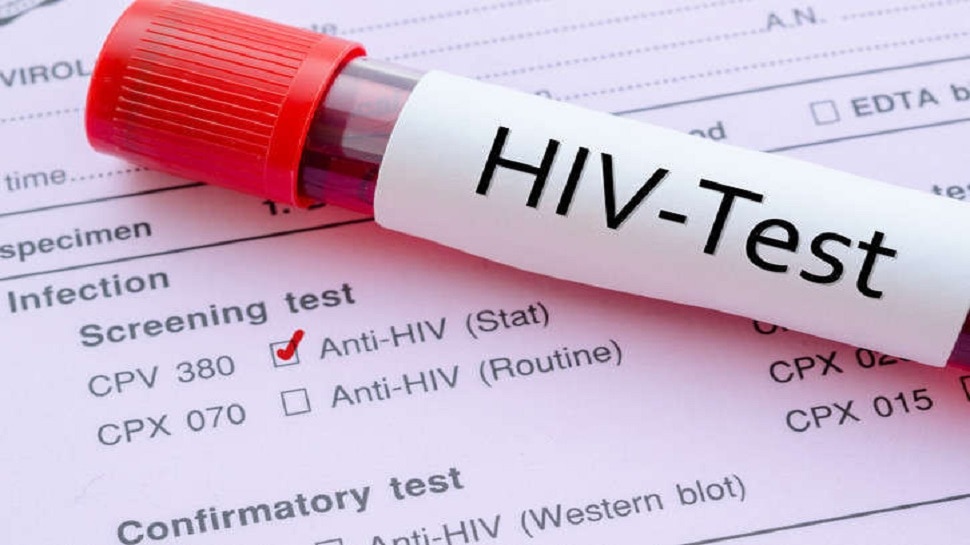 HIV Test : एचआईवी टेस्ट करवाने का ये है सही वक्त, वरना रिजल्ट मिलेगा गलत, जान लें जरूरी जानकारी