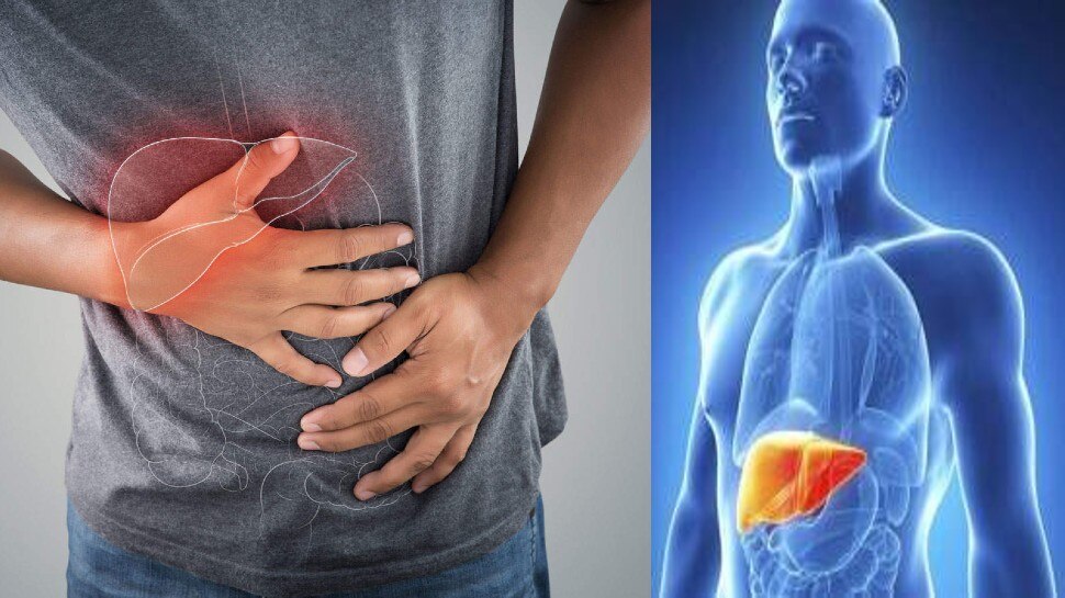 Fatty Liver Disease: सिर्फ शराब नहीं ये आदतें भी आपको बना सकती हैं फैटी लिवर का शिकार, जानिए बचने के उपाय