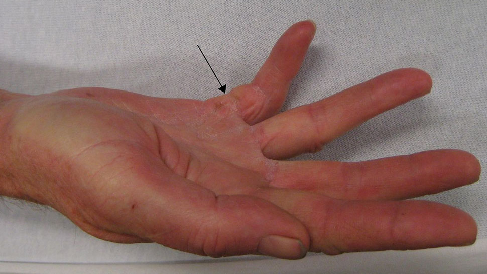 Palmistry: बहुत खास होती है हाथ की छोटी उंगली, बता सकती है आपके व्यक्तित्व का रहस्य