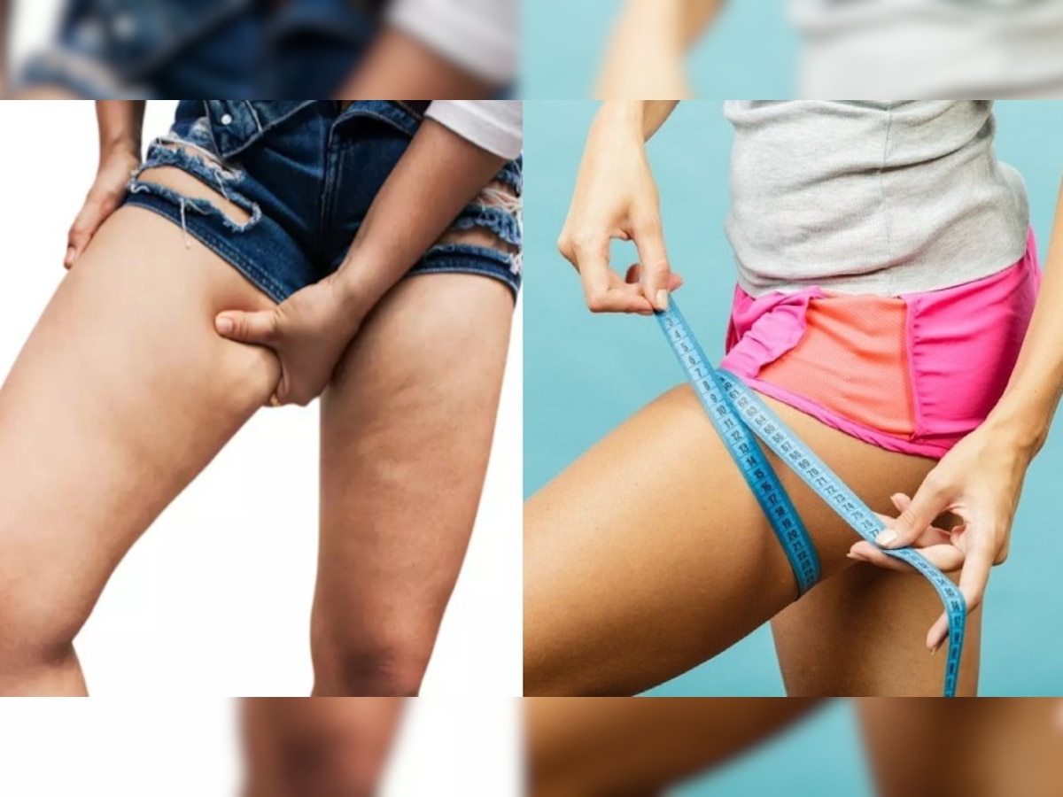 (easy ways to reduce thigh fat)