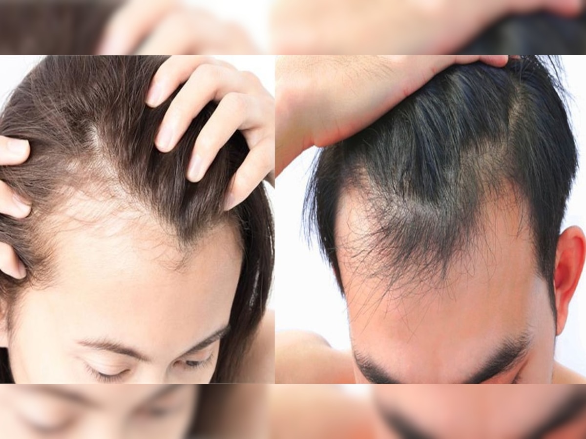 How to get rid of baldness