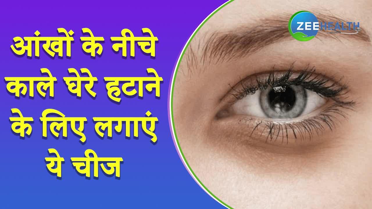 Dark circles under eyes: आंखों के नीचे अब नहीं रहेंगे काले घेरे, ये चीज करेगी मदद