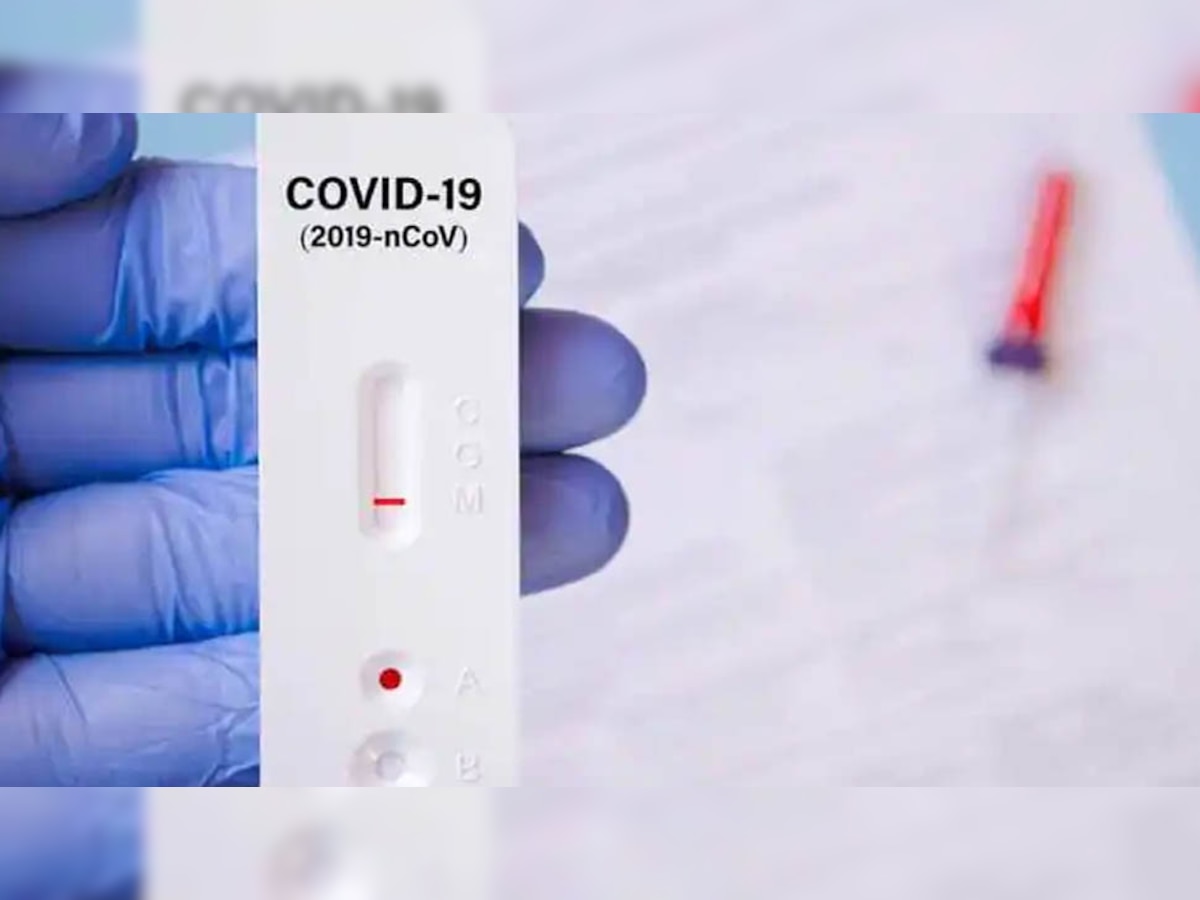 False Positive COVID Test: निगेटिव कोविड टेस्ट को भी पॉजिटिव दिखा सकते हैं ये ड्रिंक्स, स्टडी में चौंकाने वाला खुलासा 