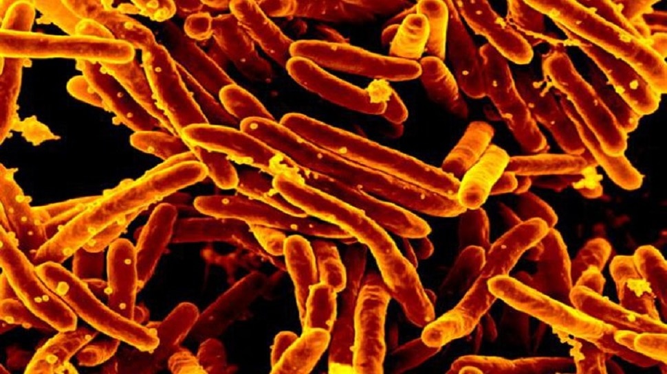 Tuberculosis: फेफड़ों के अलावा इन अंगों में भी हो सकती है टीबी, जानें सभी प्रकार और लक्षण