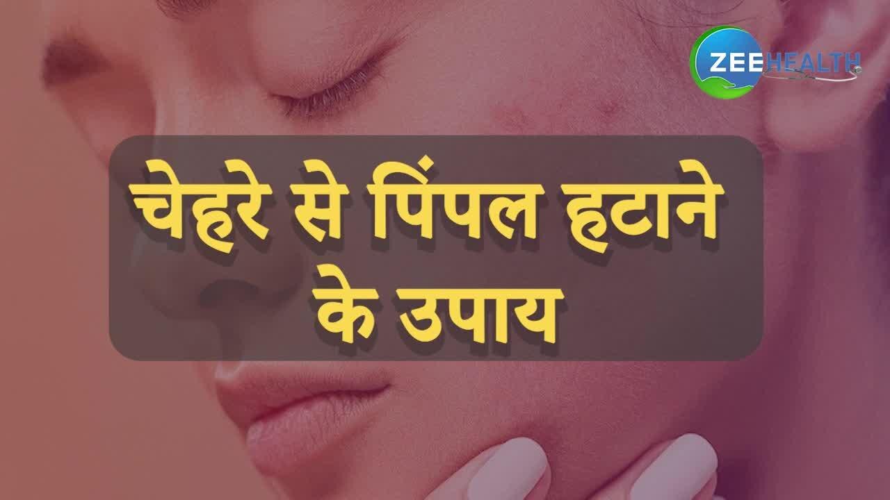 VIDEO: चेहरे से पिंपल हटाने के लिए करें ये काम, 1 मिनट में जानिए