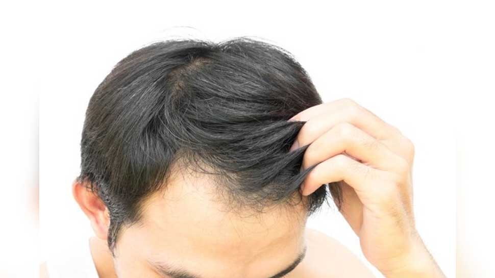 Hair Care Tips: पुरुषों को हफ्ते में कितनी बार लगाना चाहिए हेयर ऑयल? आप भी तो नहीं करते ये गलती