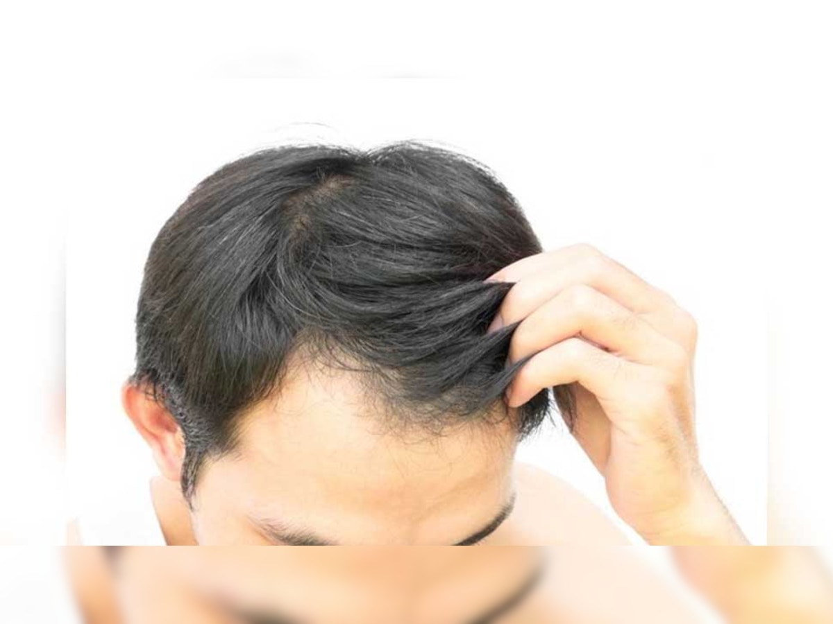 Hair Care Tips: पुरुषों को हफ्ते में कितनी बार लगाना चाहिए हेयर ऑयल? आप भी तो नहीं करते ये गलती