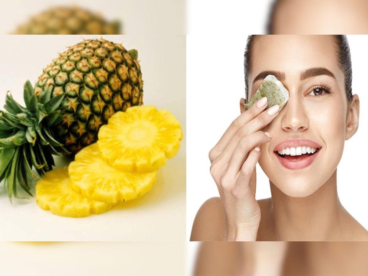 Benefits of pineapple for skin