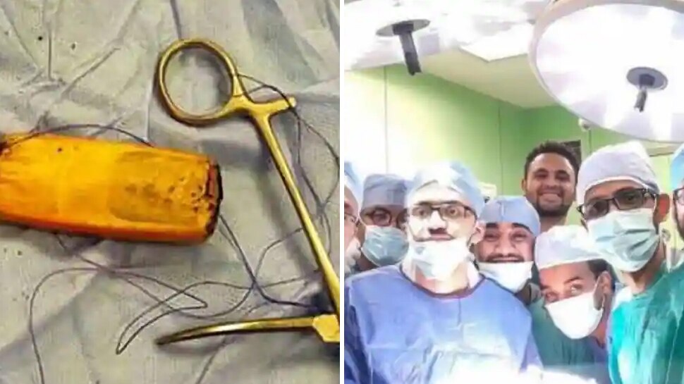 Weird News: 6 महीने तक बिना परेशान किए पेट में पड़ा रहा फोन, डॉक्टर ने जब सर्जरी किया तो उड़ गए होश