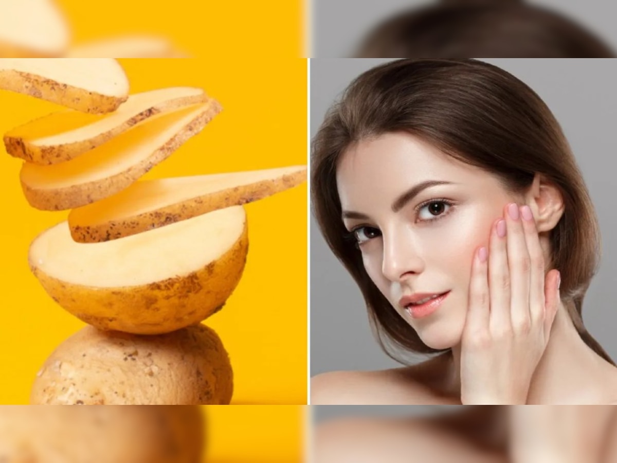 Benefits of potato face pack