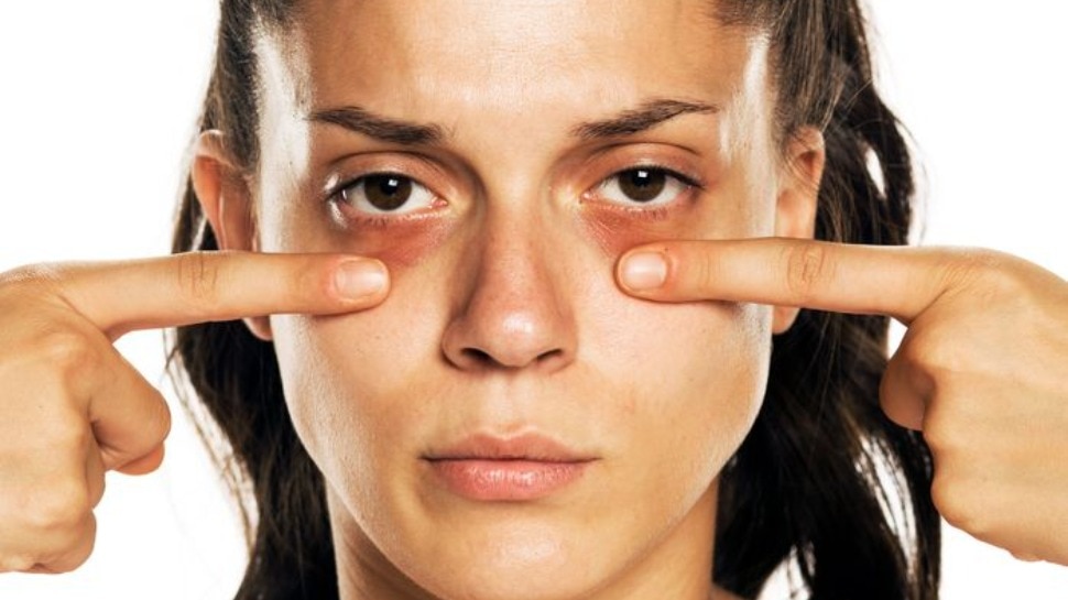 Dark Circles Home Remedies: डार्क सर्कल खत्म करने का अचूक उपाय, ये नुस्खे अपनाएं फिर देखें गजब का कमाल