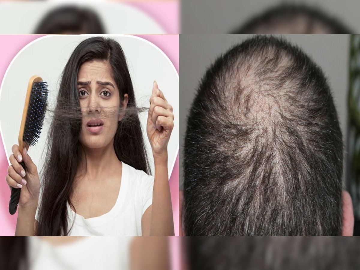 Reason of hair loss