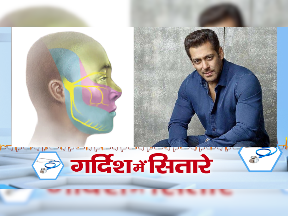 Salman Khan suffered from Trigeminal Neuralgia