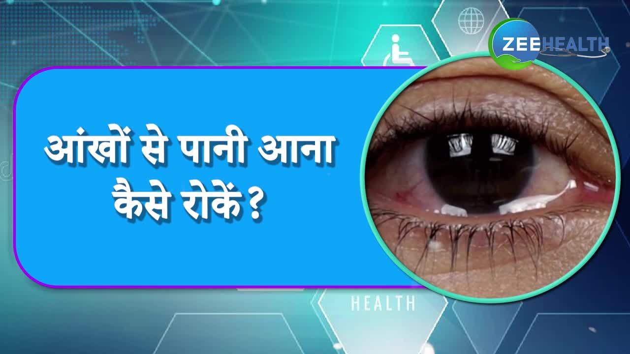 how-to-treat-watery-eyes-know-why-water-comes-from-eyes-samp