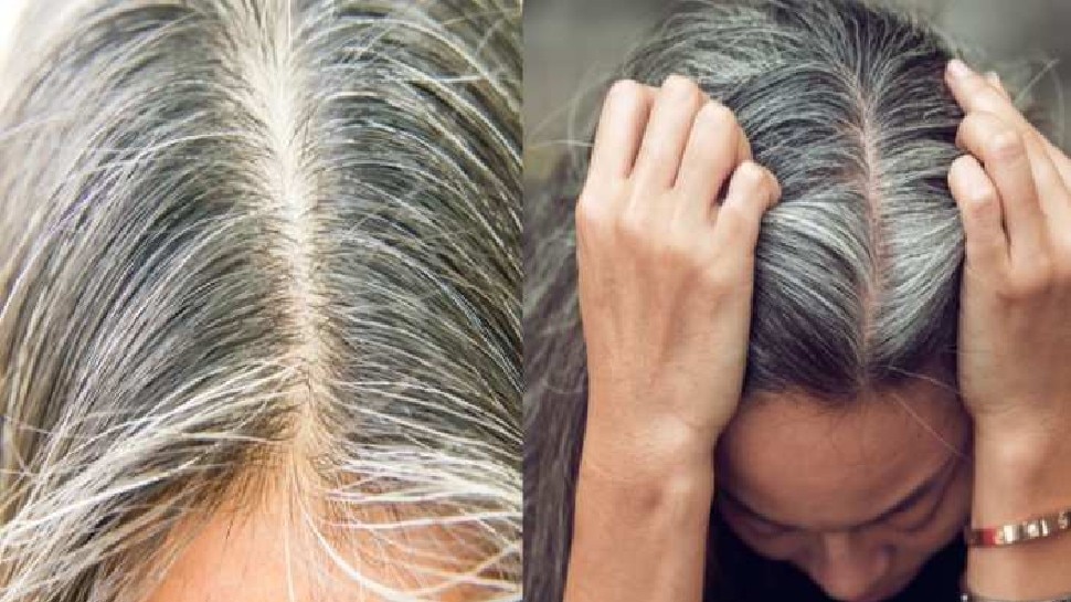 White hair problem solution: झड़ते और सफेद होते हैं बाल तो करें ये काम, हेयर हो जाएंगे काले, घने और मजबूत