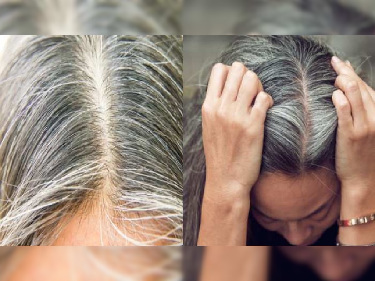  White hair problem solution