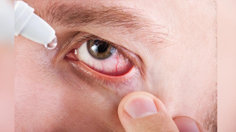 eye problem Symptoms of an Eye Infection eye Pain itchy eyes क्या