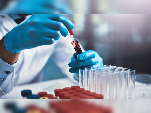 अलामती तस्वीर 