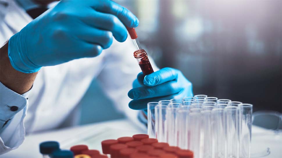 रिसर्च में खुलासाः इस ब्लड ग्रुप (Blood Group) के लोगों को है कोविड से ज्यादा खतरा रिसर्च में खुलासाः इस ब्लड ग्रुप (Blood Group) के लोगों को है कोविड से ज्यादा खतरा