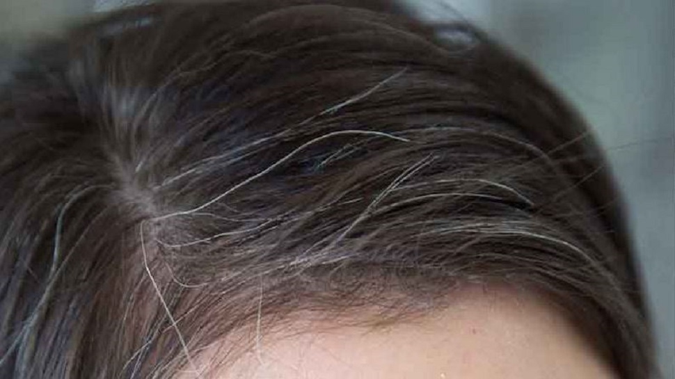 Hair Care Tips: କେଶ ଧଳା ହୋଇଯାଉଛି କି? ସକାଳୁ ଉଠି ପ୍ରତିଦିନ ଗୁଡ଼ ସହ ଖାଆନ୍ତୁ ଏହି ମଞ୍ଜି Hair Care Tips: କେଶ ଧଳା ହୋଇଯାଉଛି କି? ସକାଳୁ ଉଠି ପ୍ରତିଦିନ ଗୁଡ଼ ସହ ଖାଆନ୍ତୁ ଏହି ମଞ୍ଜି