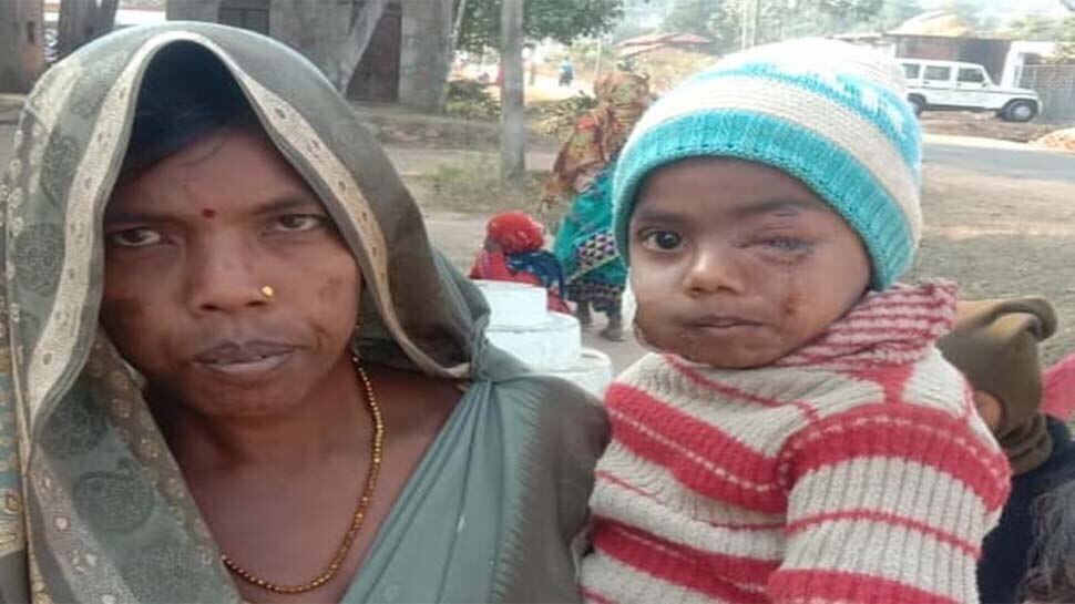 मिलिए उस मां से, जिसने आदमखोर तेंदुए के जबड़े से अपने जिगर के टुकड़े को छीन लिया
