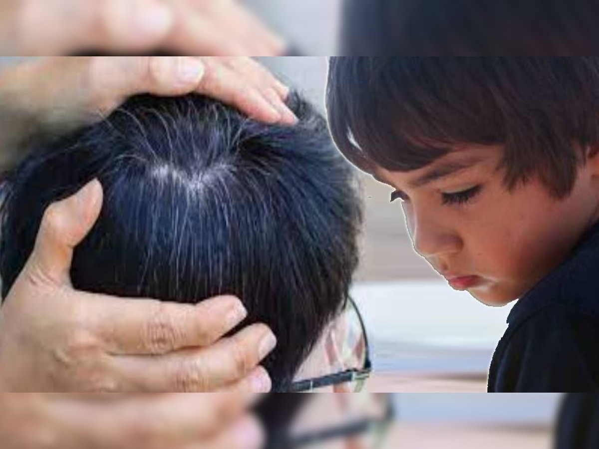 causes of white hair in kids know home remedies of white hair problem ...