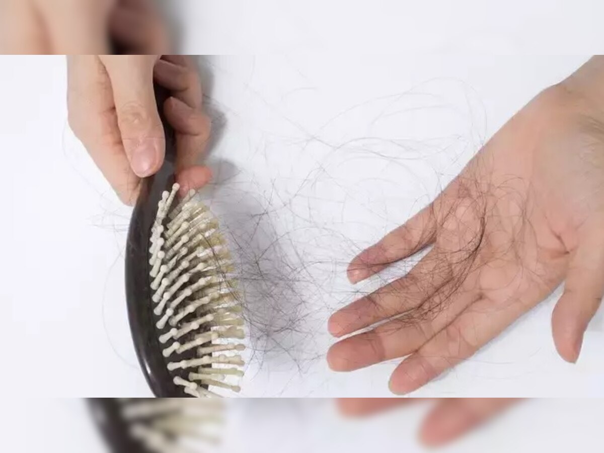 Hair Care Tips: आपकी इन 5 गलतियों की वजह से तेजी से टूटते-झड़ते हैं बाल, जानें बचाव का तरीका