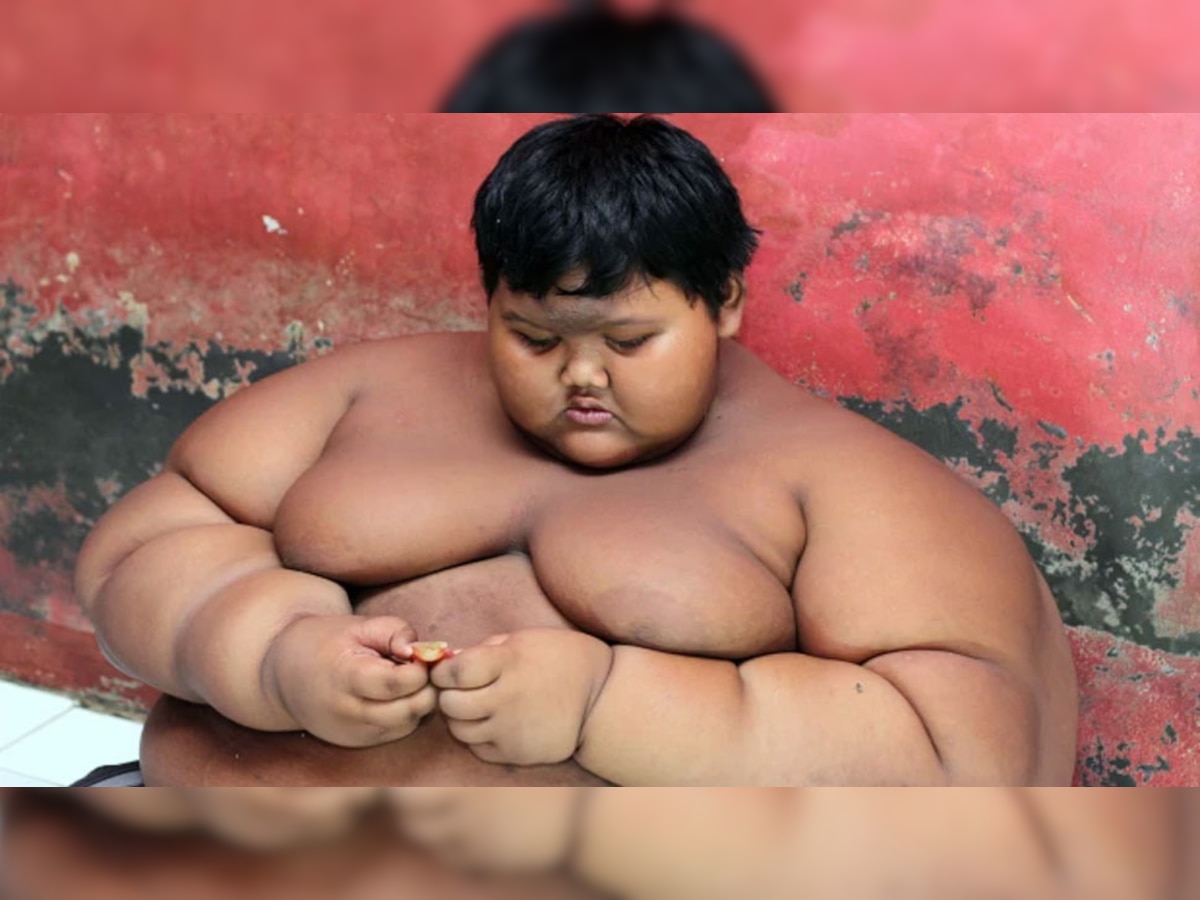10 साल के बच्चे का 200 किलो वजन! बाथरूम की जगह तालाब में नहाने को मजबूर  
