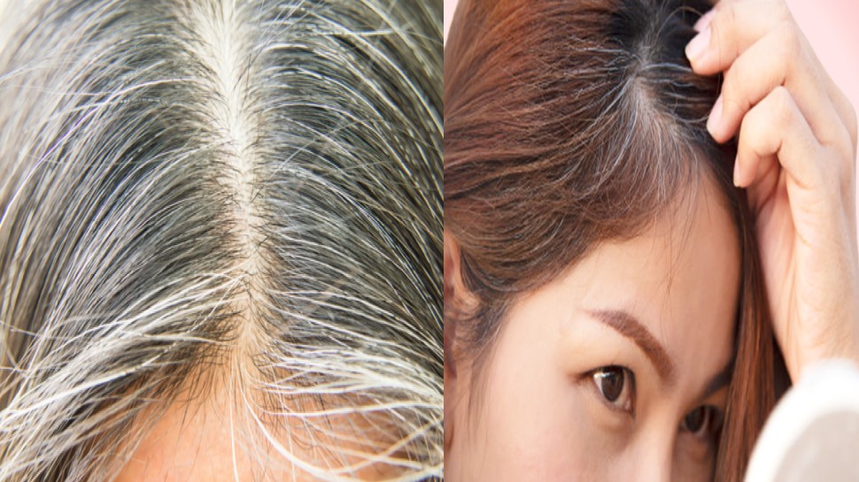 White Hair की Problem को हमेशा के लिए खत्म कर देंगे ये 3 उपाय, बाल हो जाएंगे काले-घने और मजबूत