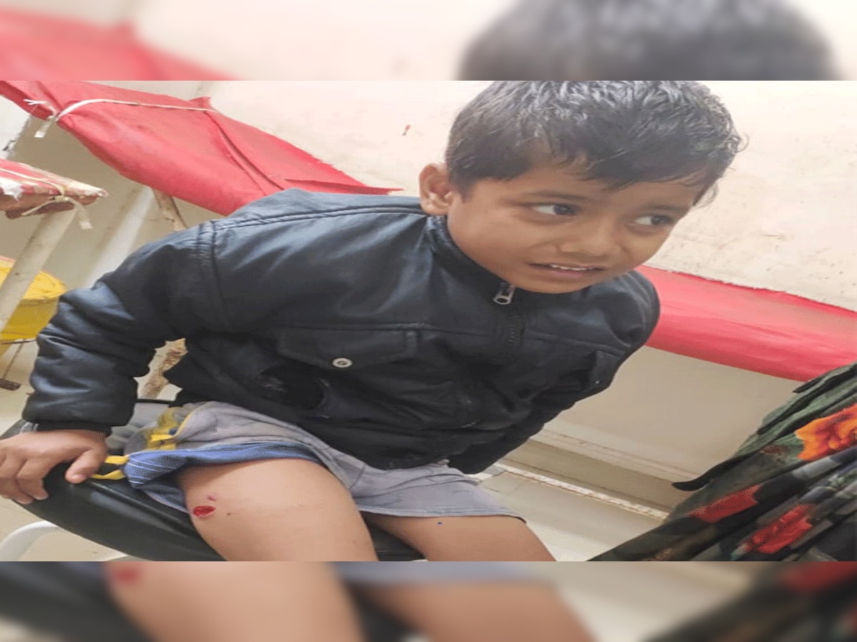 माला देवी बस्ती में बदंरों ने बच्चों पर किया हमला