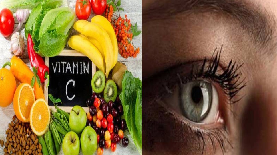 Vitamin C deficiency: शरीर में Vitamin C की कमी से झड़ने लगते हैं बाल, आंखों की रोशनी होने लगती है कम, इन चीजों को खाने से मिलेगा लाभ