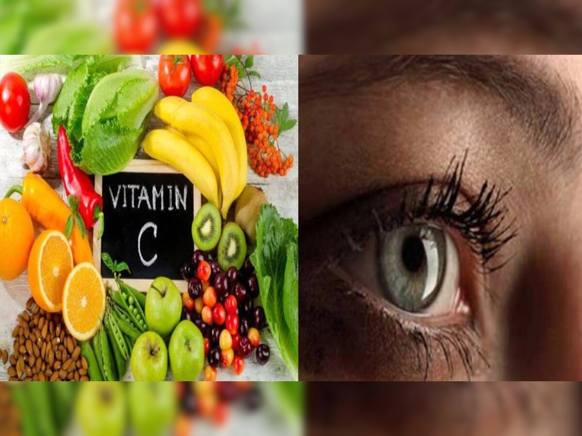 Vitamin C deficiency