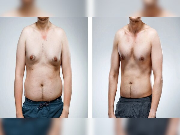 सांकेतिक तस्वीर