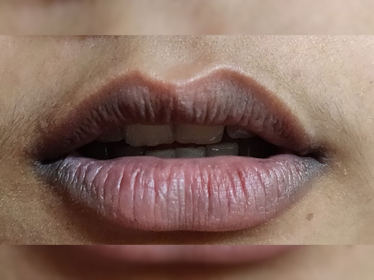Dark Lips: आपके खूबसूरत होंठ हो रहे हैं काले? तुरंत छोड़ दें अपनी 5 बुरी आदतें