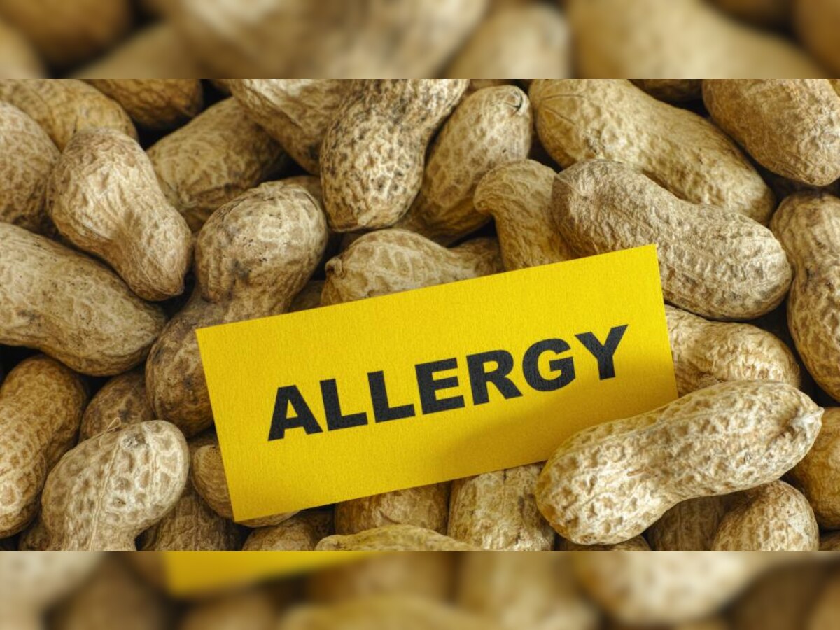 health tips Peanuts can be bad for your health Side effects of peanuts will shock you Side