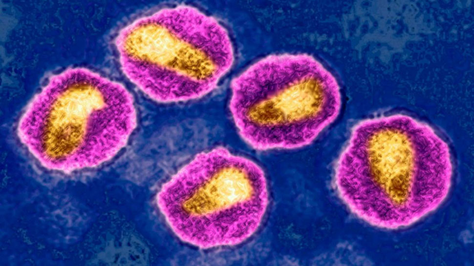 नई तकनीक का कमाल, पहली बार किसी महिला का HIV पूरी तरह हुआ ठीक