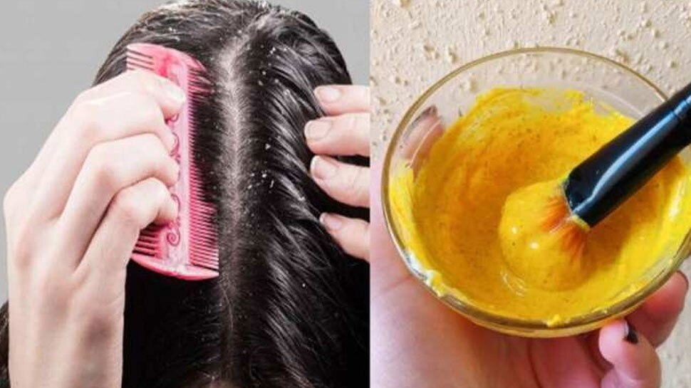 Turmeric for Hair Removal Your Questions Answered