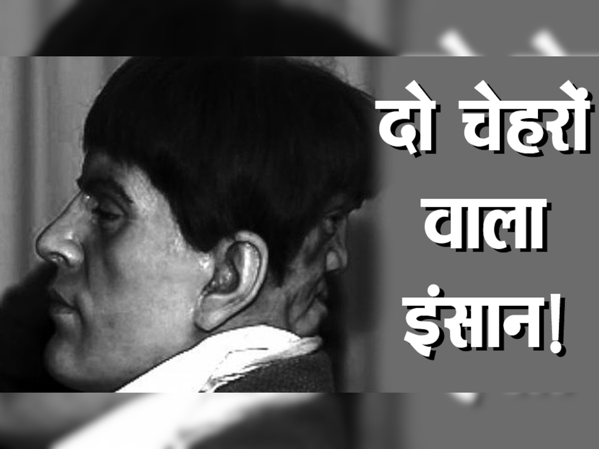 इस शख्स के सिर पर थे दो चेहरे! आज भी लोगों के लिए बना हुआ है रहस्यमयी इंसान