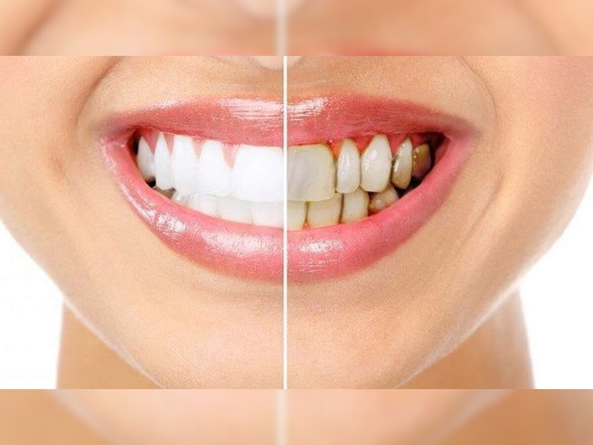 Teeth Staining Foods Tea Candy Tomato Sauce Energy Drinks Carbonated Fruits Blueberry Blackberry