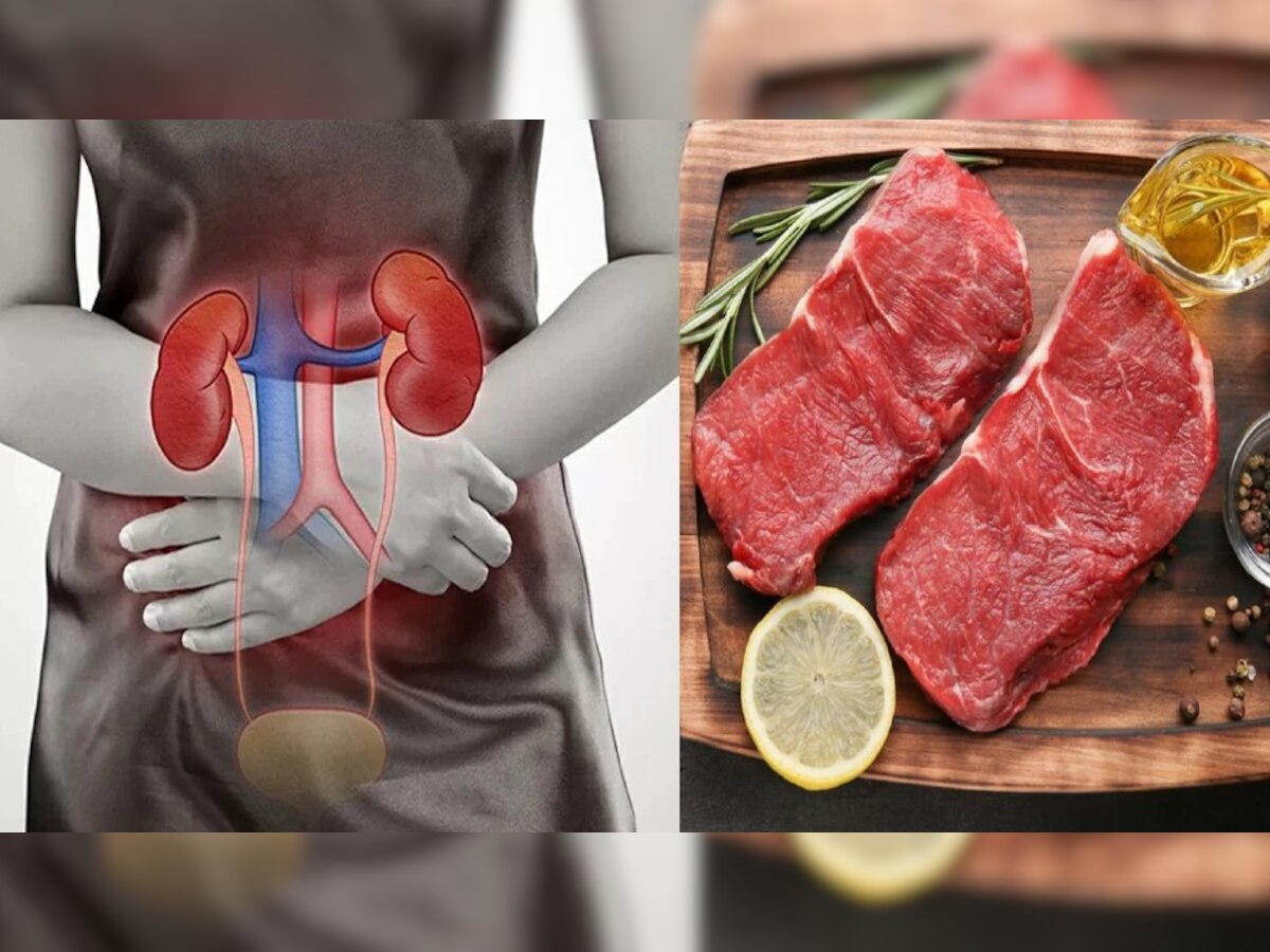 Harmful Foods For Kidney
