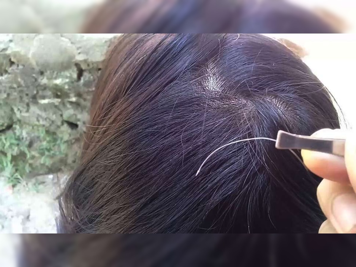 White Hair Problems: जब पहली बार सिर पर दिखे सफेद बाल, तो न करें तोड़ने की गलती; अपनाएं ऐसी ट्रिक 