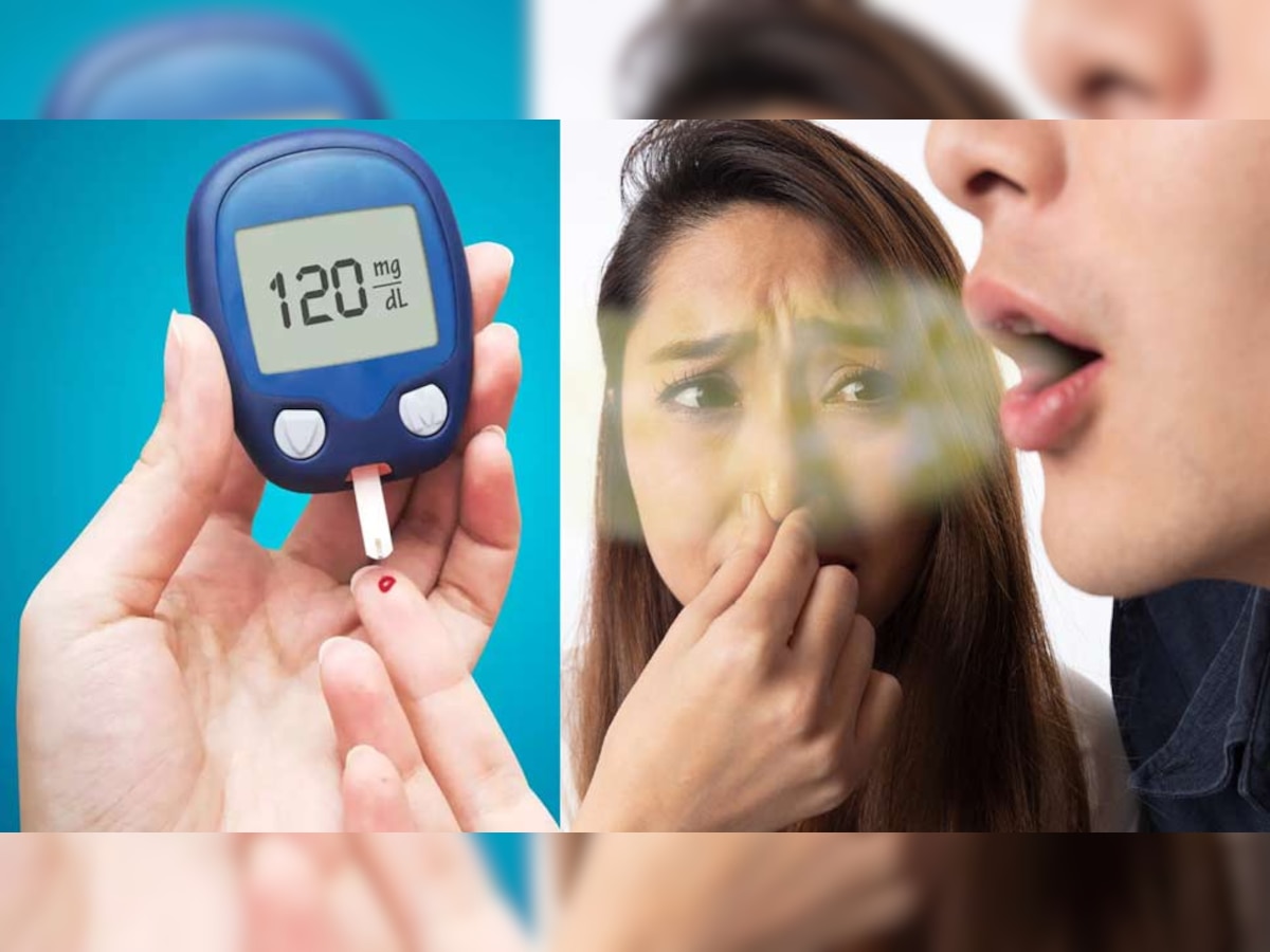 Bad Breath: मुंह की बदबू कहीं डायबिटीज इशारा तो नहीं? माउथ टेस्ट खोल देगा राज
