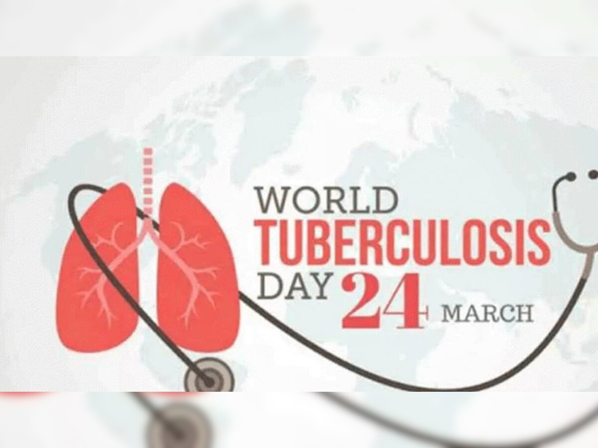 World Tuberculosis Day 2022: वर्ल्ड टीबी डे आज, रखें इन जरूरी बातों का ध्यान, नहीं तो हो जाएगी मुसीबत