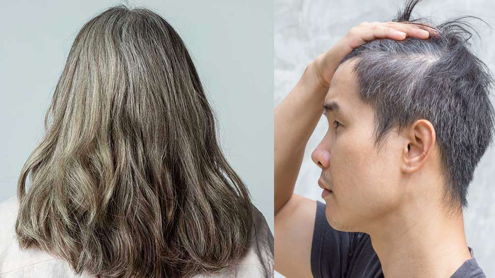 How to delay premature grey hair  Causes for premature grey hair