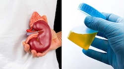Kidney Failure: इस रंग का आता है यूरिन तो हो जाएं अलर्ट, ये किडनी फेल होने का इशारा