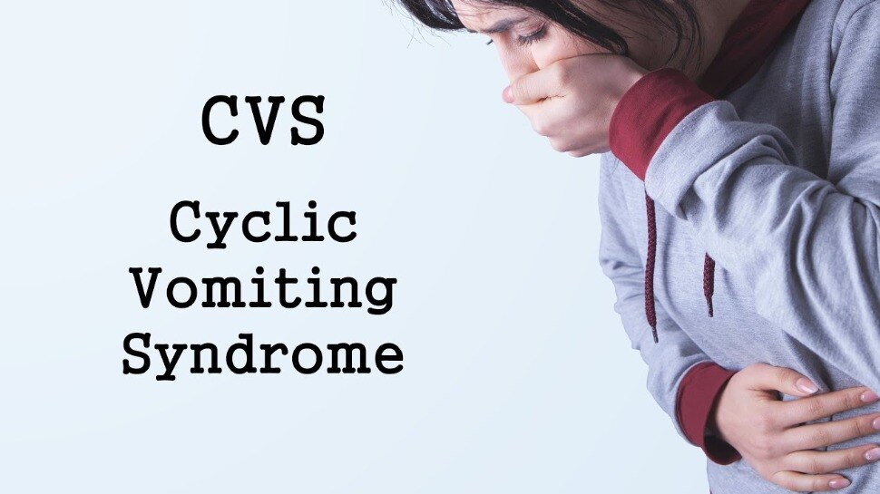 Cyclic Vomiting Syndrome A rare disease caused by a person vomits