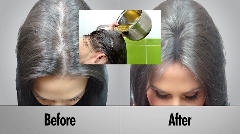 110 Hair Fall रकन क 5 उपय  7 Days Treatment in Hindi