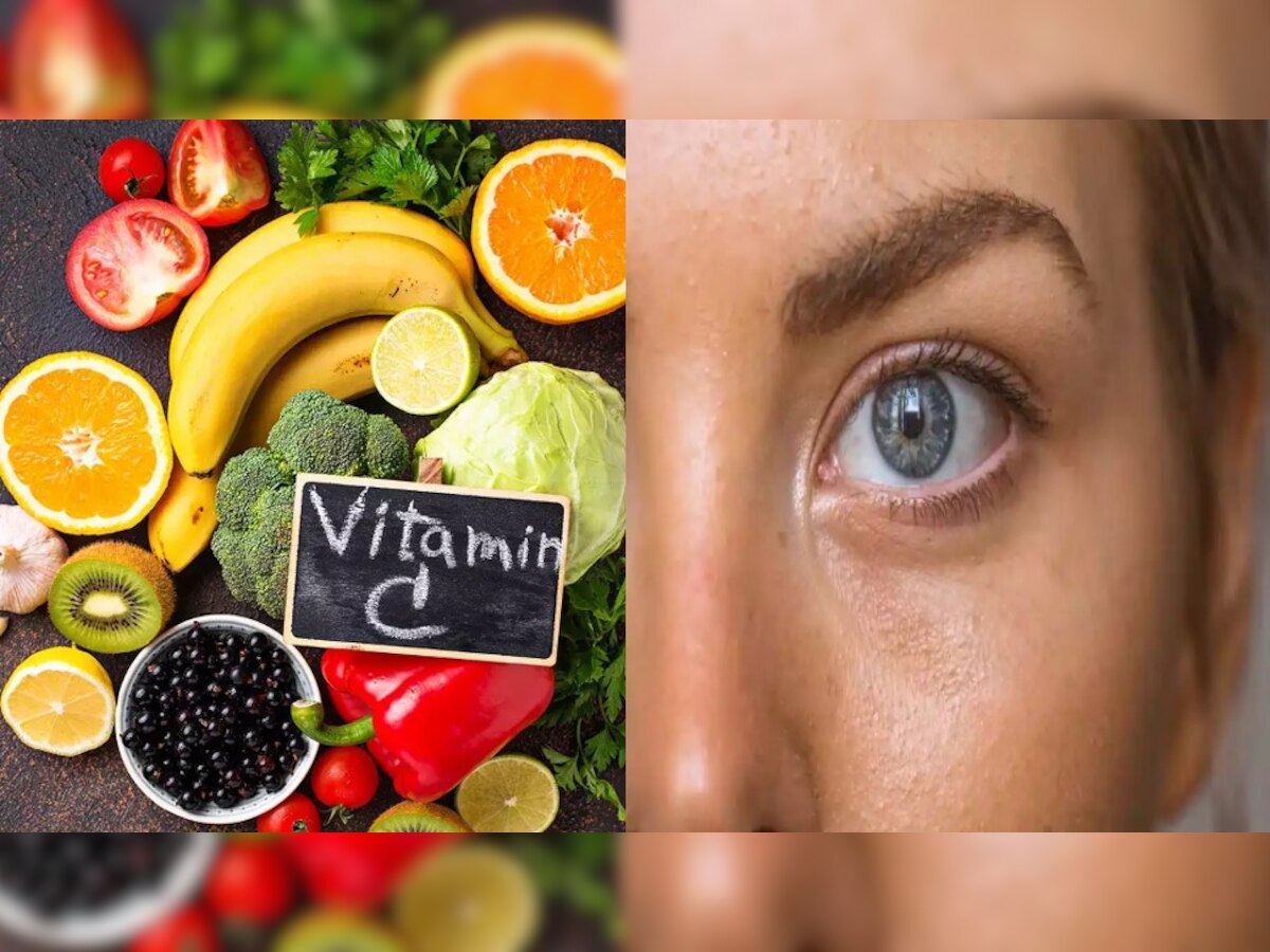 Vitamin C deficiency diseases