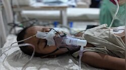 बढ़ती गर्मी के साथ मुजफ्फरपुर में बढ़ा चमकी बुखार का कहर, तीन नए मामले की पुष्टि