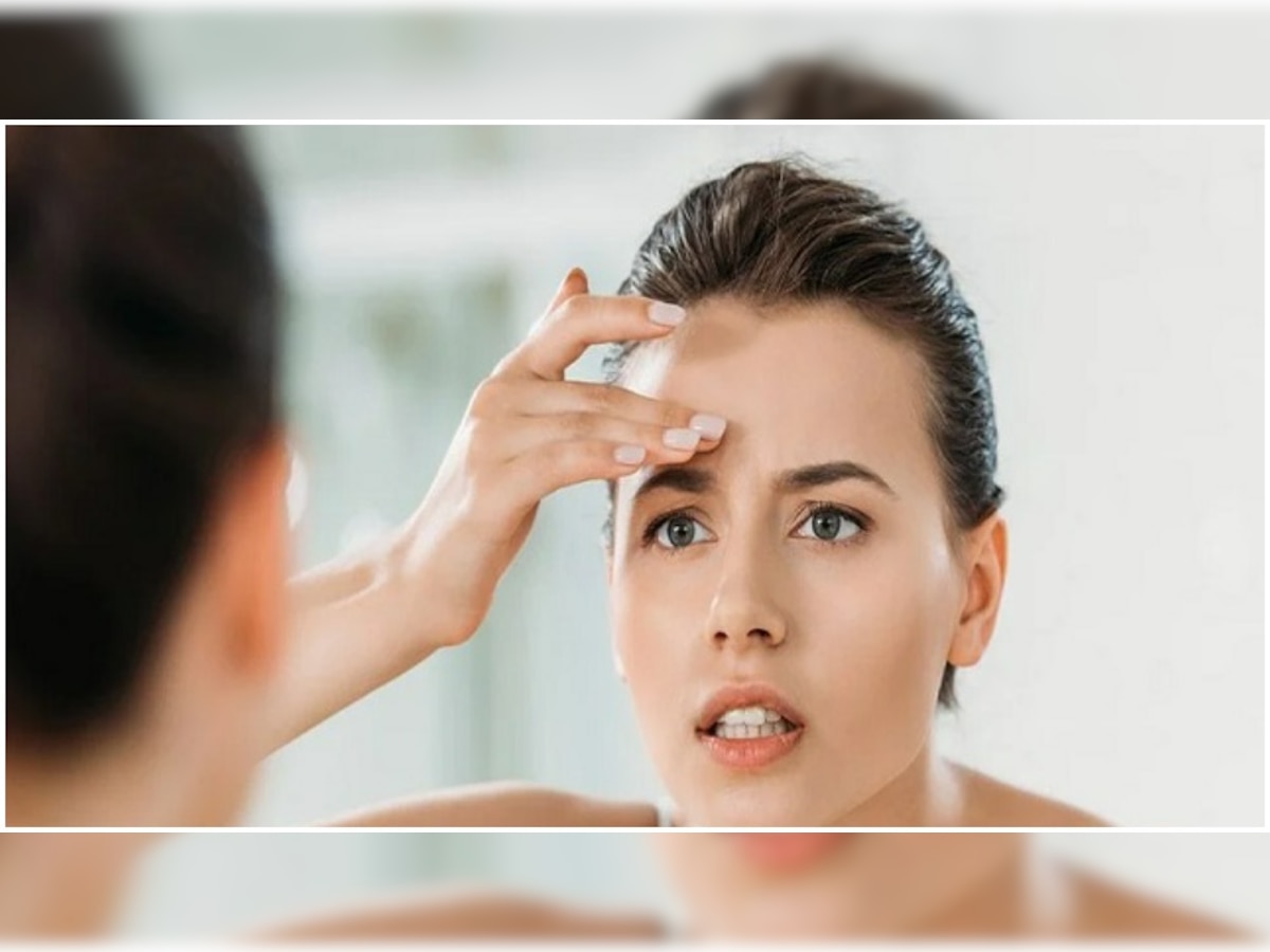 Skin Care Tips:आईब्रो के बीच हो रहे दानों से हैं परेशान? तो इन तरीकों से पाएं छुटकारा